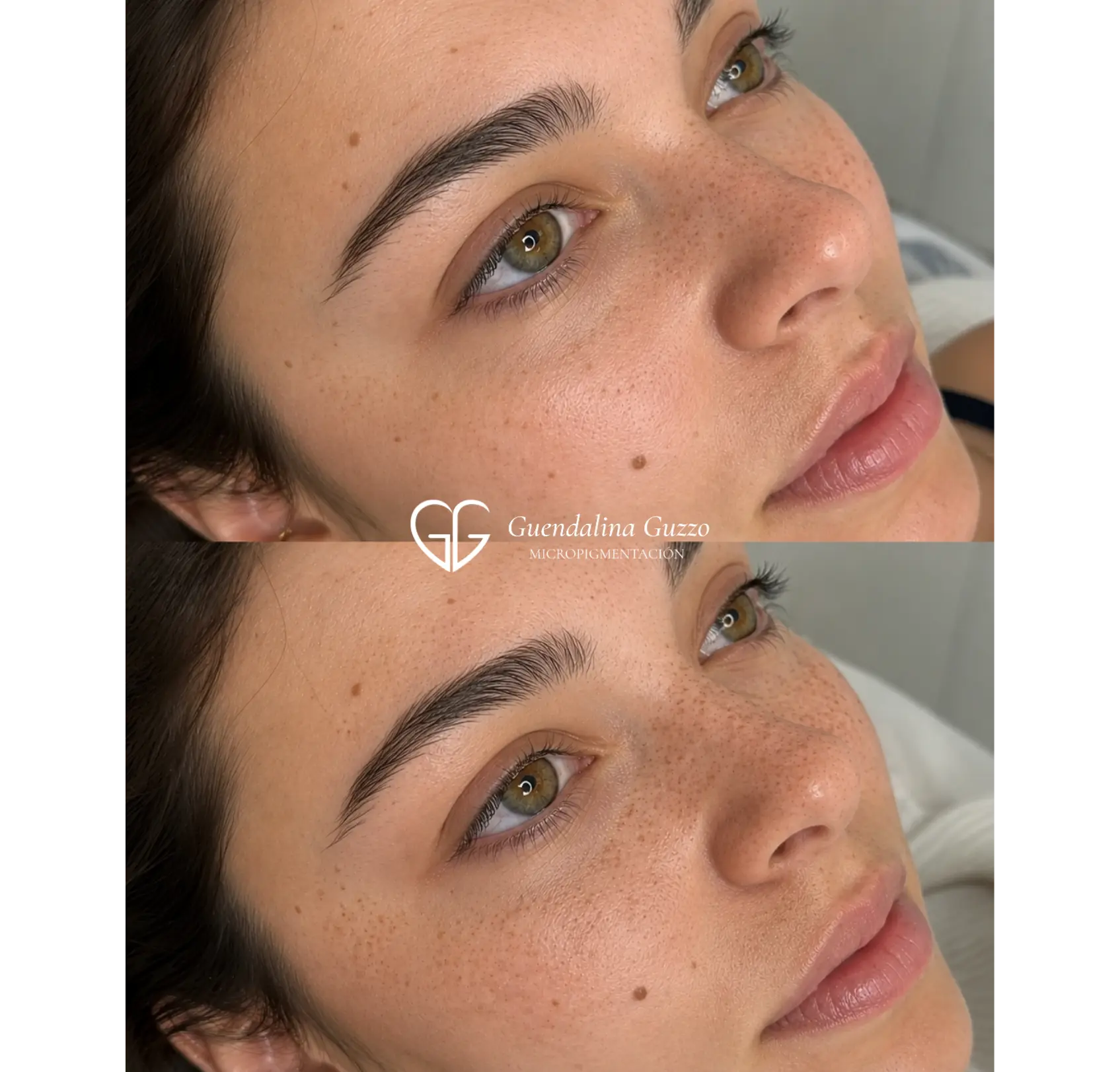 Resultado de micropigmentación de pecas natural en Marbella por Guendalina Guzz