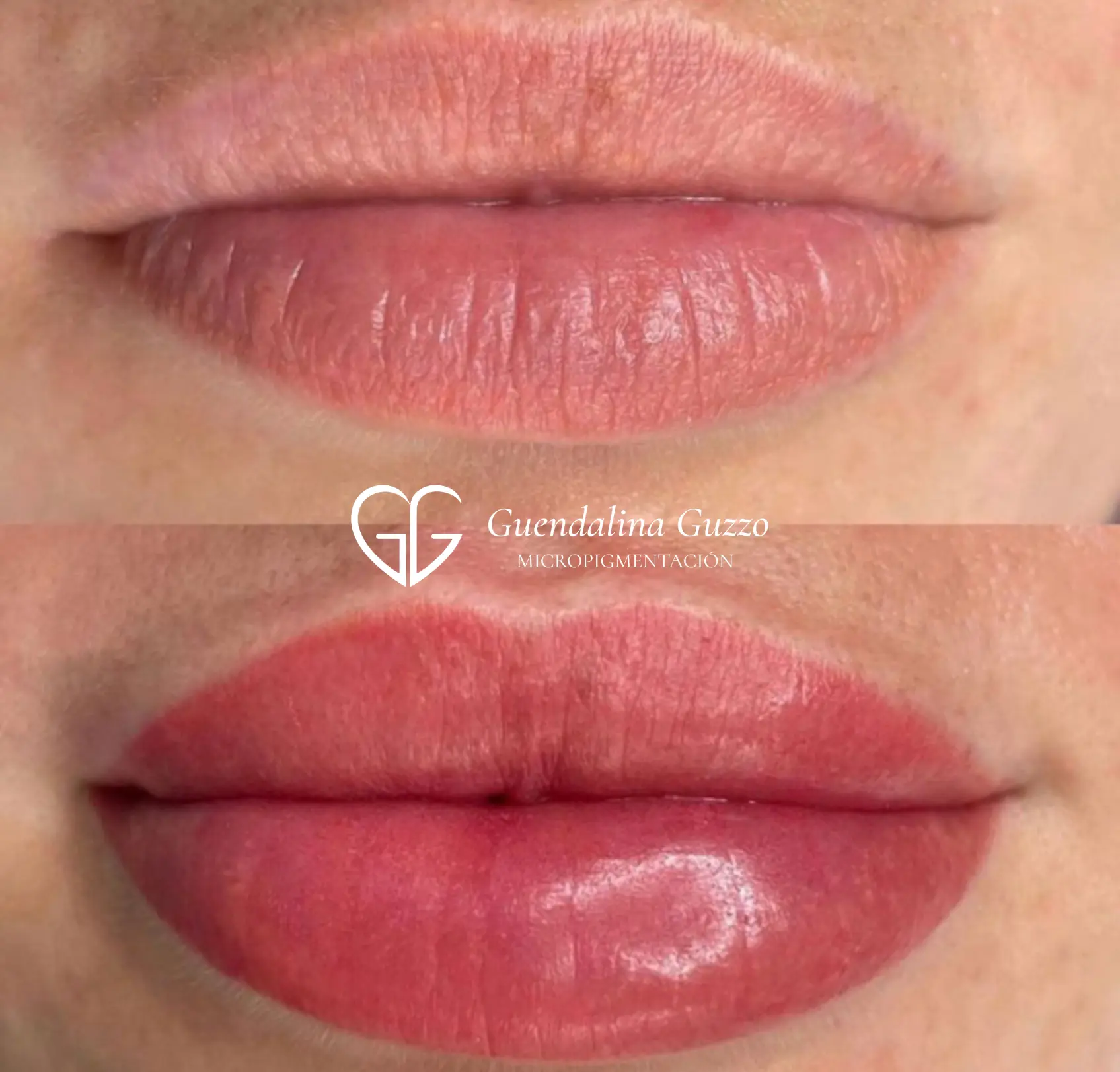 Resultado antes y después de micropigmentación de labios con efecto color y definición en Marbella por Guendalina Guzzo.