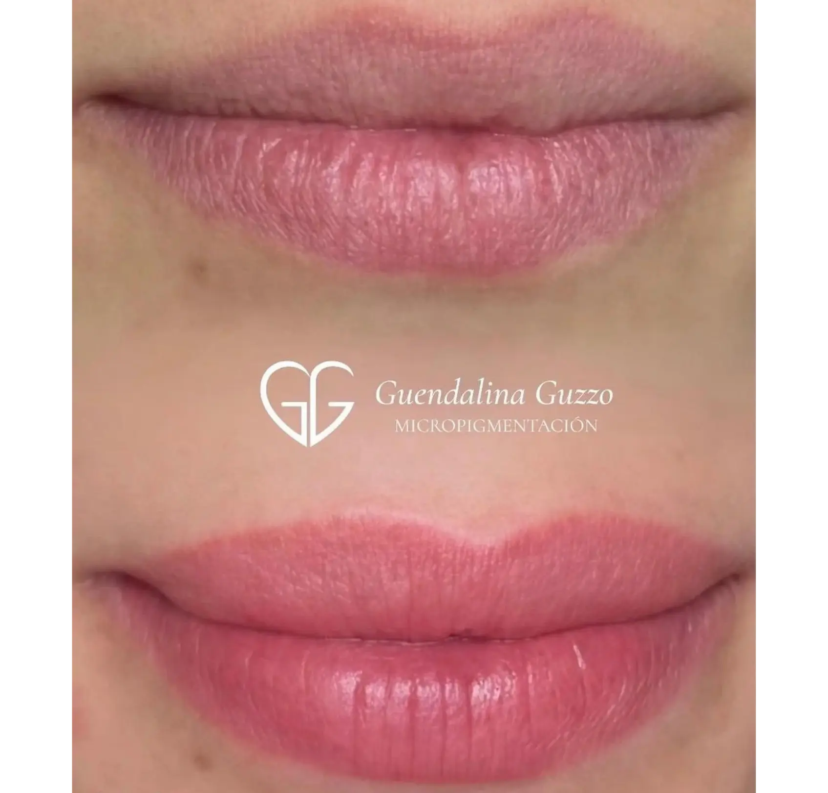Antes y después de micropigmentación de labios con técnica efecto natural para mejorar definición, Guendalina Guzzo en marbella.