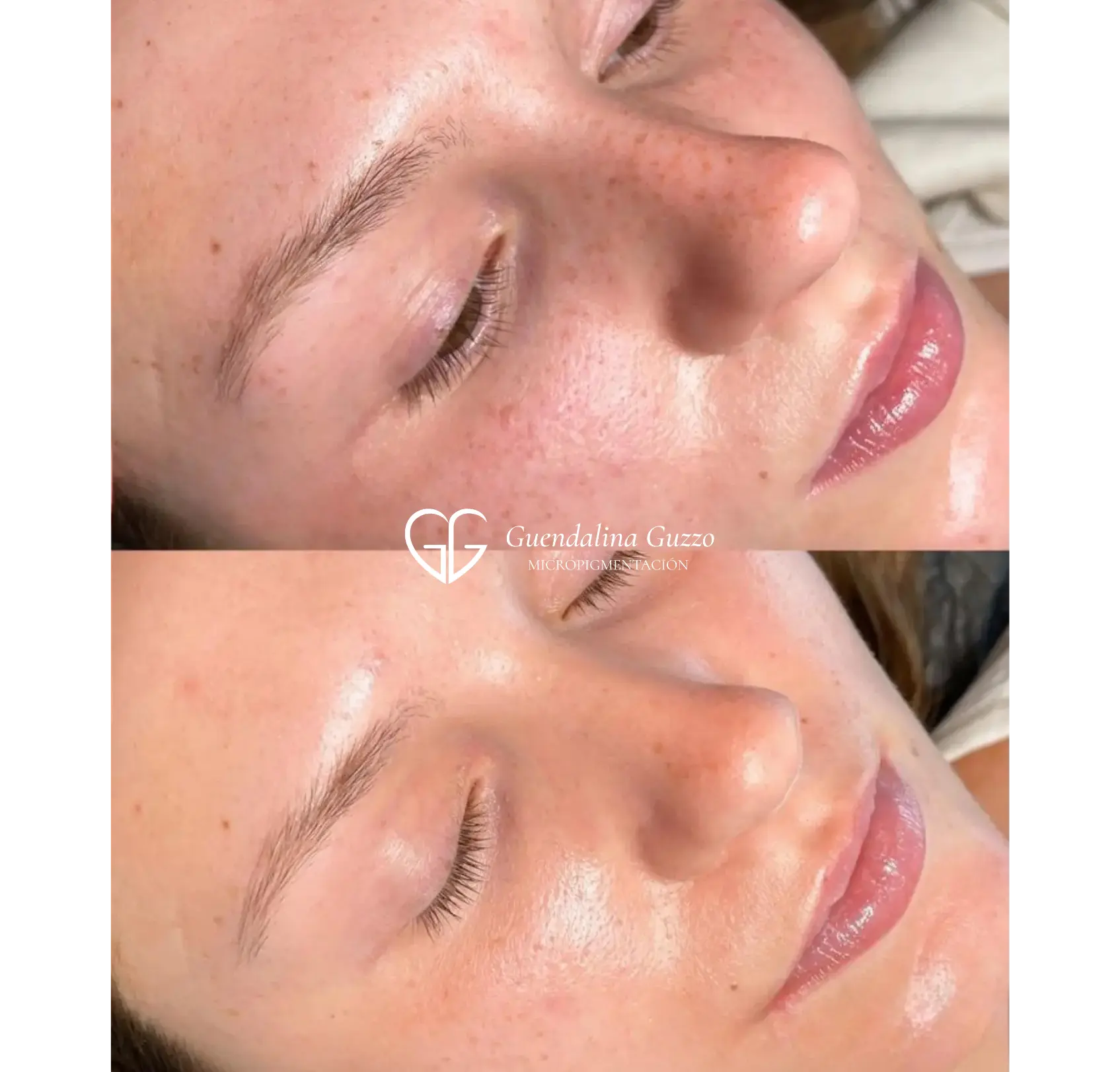 Comparativa de antes y después de micropigmentación de pecas y lunares en nariz y mejillas para un efecto natural - Guendalina Guzzo en Marbella